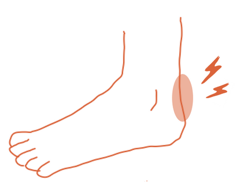 Kesou|かかとが合っていない場合